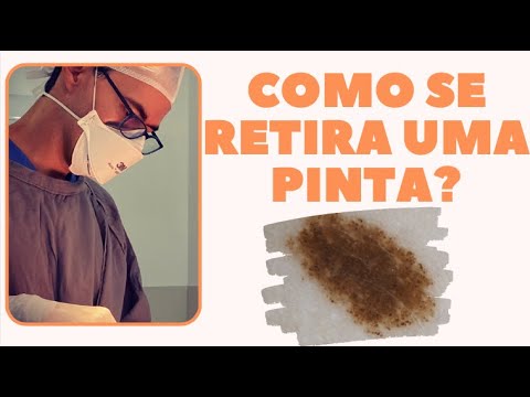 A Queda de Pintas: Uma Ocorrência Comum e Natural