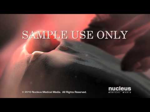 A Conexão entre DIP e Ovulação: Entenda os Conceitos e Implicações