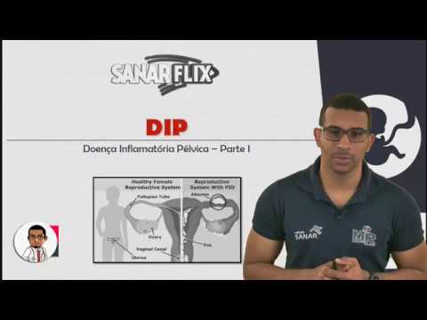 Entenda de forma clara e detalhada como ocorre a aquisição da DIP