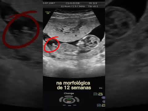 O Impacto do Corte de Energia Elétrica Durante a Gravidez: Direitos e Proteções Legais