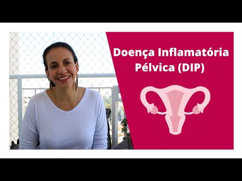 Sequelas da DIP: Conheça as Implicações de Longo Prazo da Doença Inflamatória Pélvica