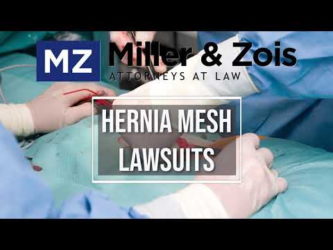The Timeframe for Resolving a Hernia Mesh Lawsuit: Explained