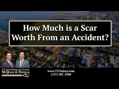 Understanding the Valuation of Scars in Lawsuits: A Comprehensive Analysis