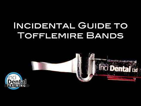 Understanding the Concept of Retainers in UK Law: A Comprehensive Guide