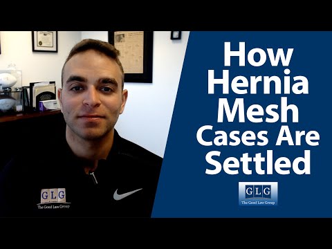 Understanding Average Settlement Amounts in Mesh Lawsuits