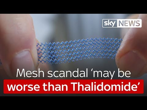 Understanding the Duration of a Mesh Lawsuit: A Comprehensive Analysis