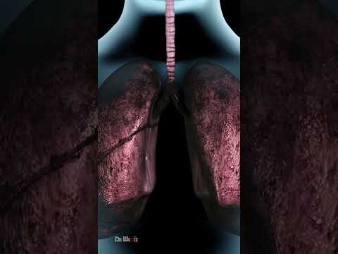 Understanding the Smoking Act 2005: An Informative Guide